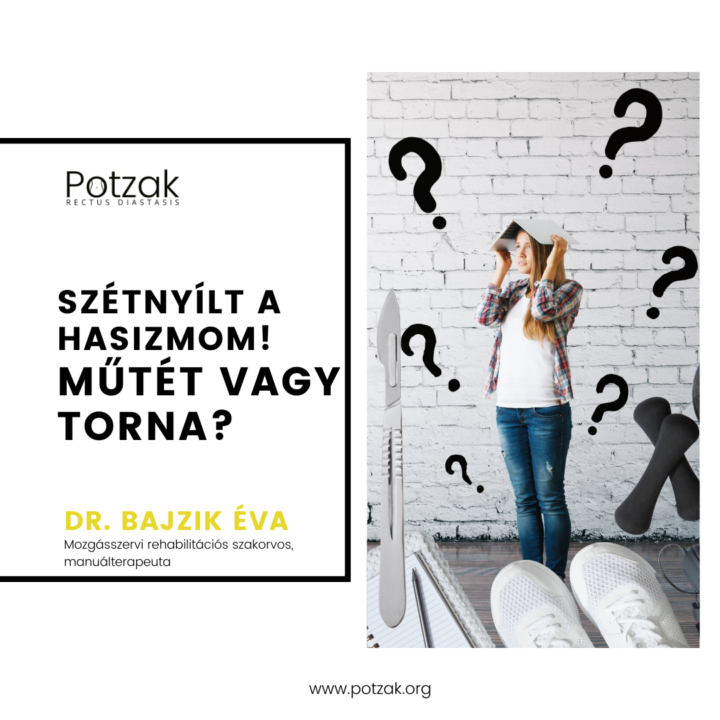 Potzak – Szétnyílt hasizom – Műtét vagy torna